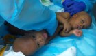 Une équipe médicale tunisienne réussit à séparer des siamois camerounais